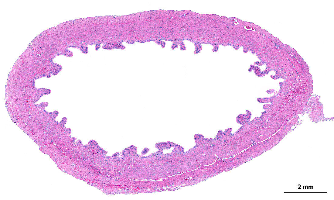 Urinary bladder, light micrograph