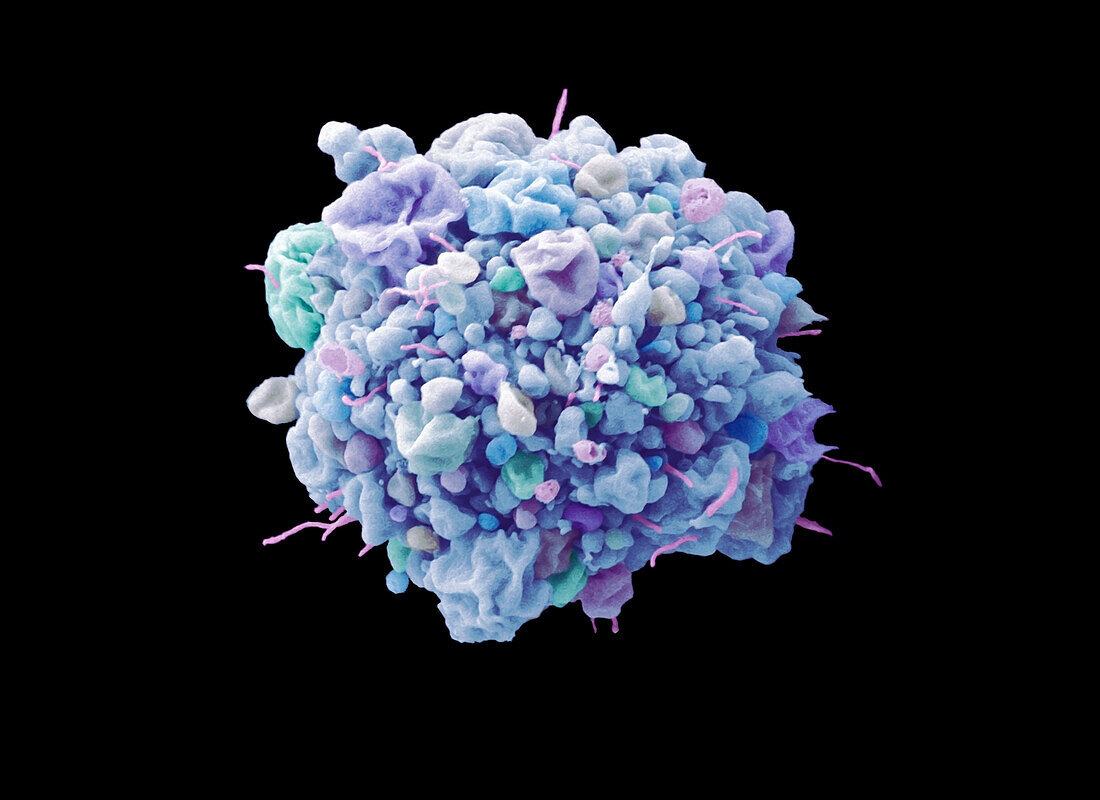 Cervical cancer cell apoptosis, SEM