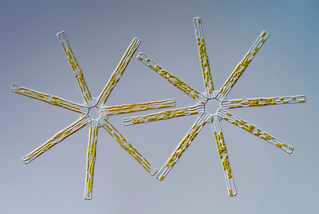 Tabellaria fenestrata , light micrograph