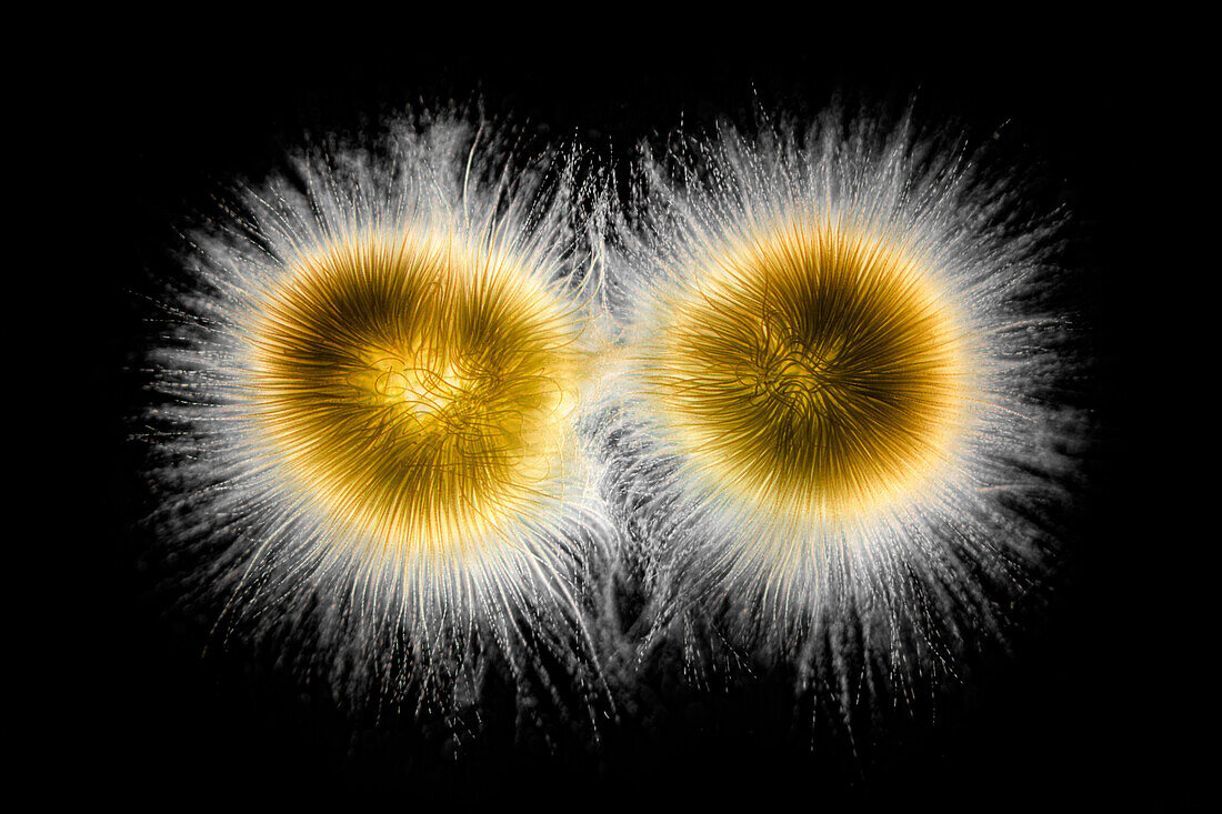 Gloeotrichia sp. cyanobacteria, light micrograph