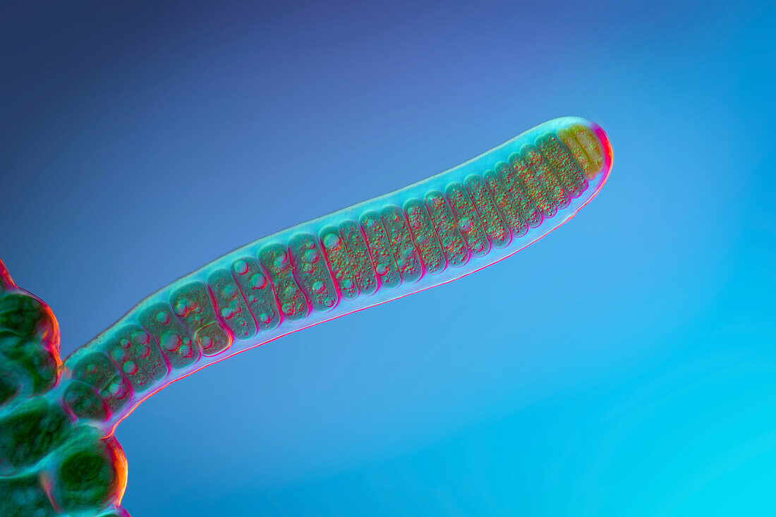 Stigonema mammilosum cyanobacteria, light micrograph