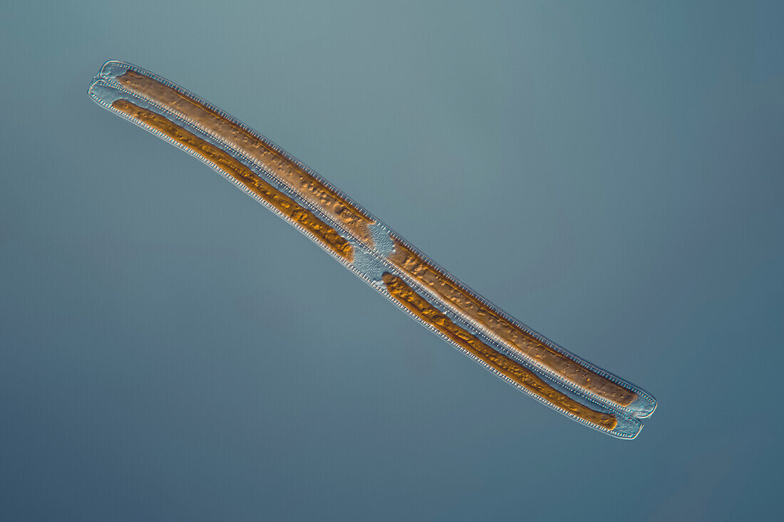 Pennate diatom, light micrograph