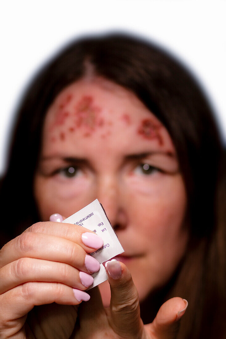 Patient with basal cell carcinoma putting on imiquimod cream