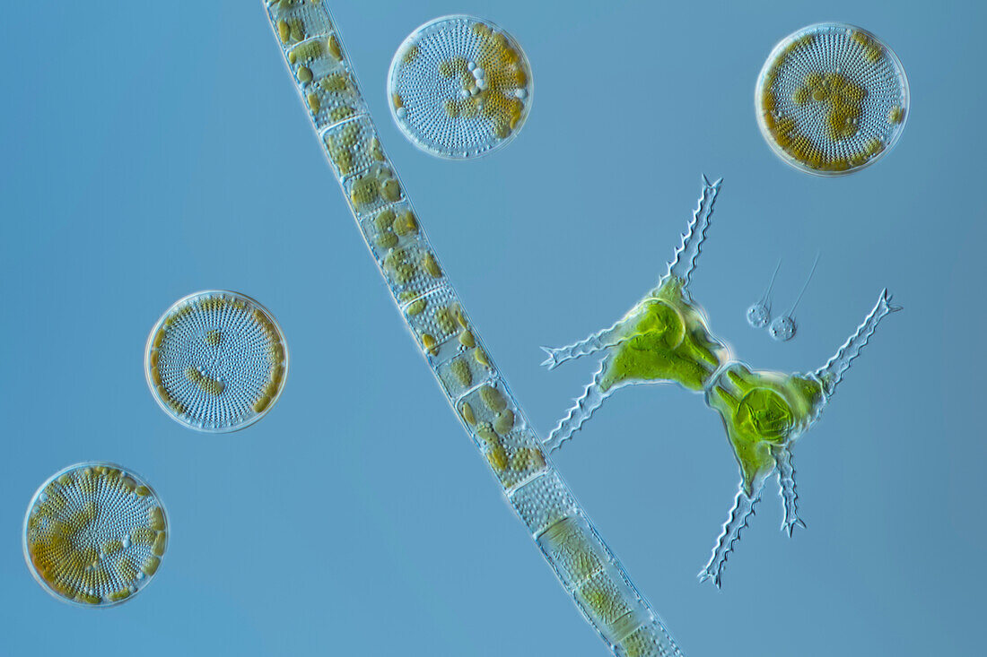 Green alga and diatoms, light micrograph