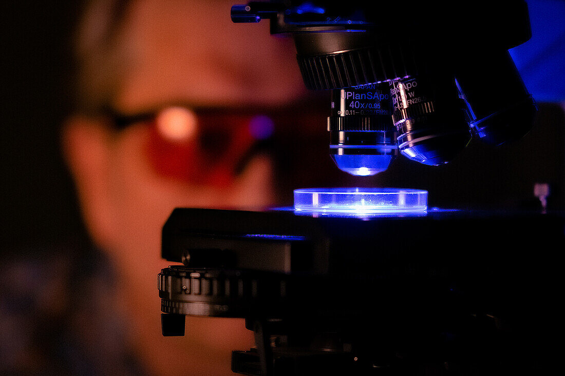 Fluorescence microscopy