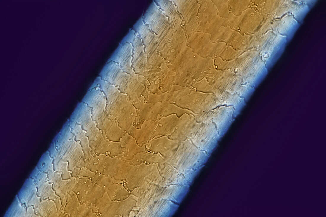 Strand of human hair, light micrograph