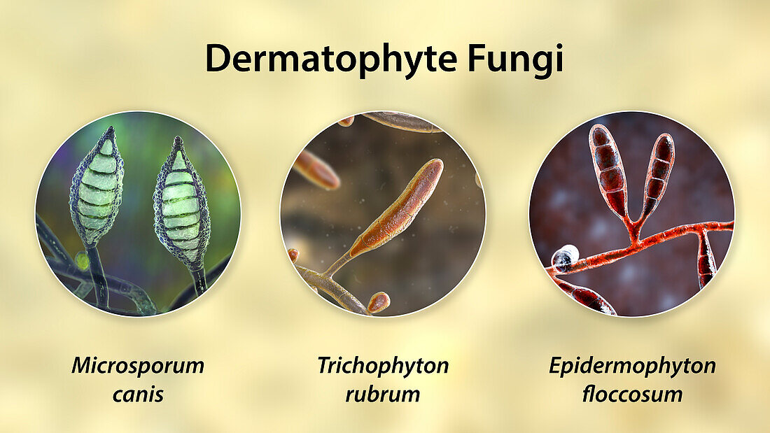 Dermatophyte fungi, illustration