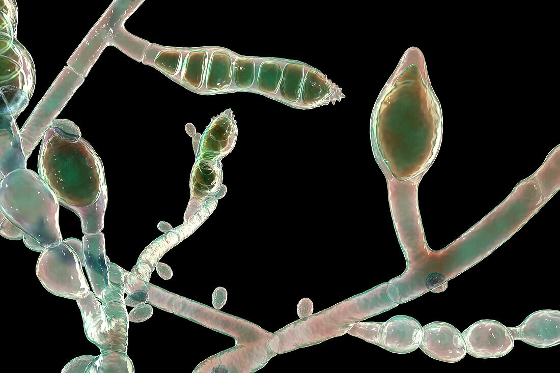 Microsporum audouinii fungus, illustration
