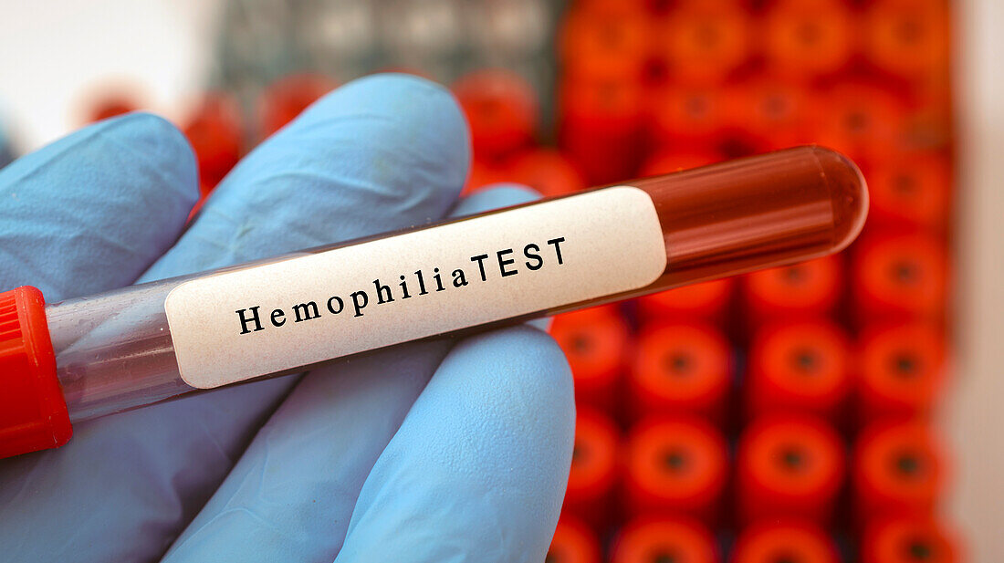 Haemophilia blood test, conceptual image
