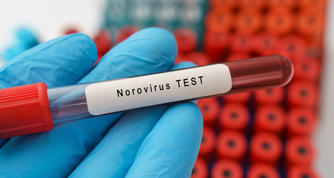 Norovirus test, conceptual image