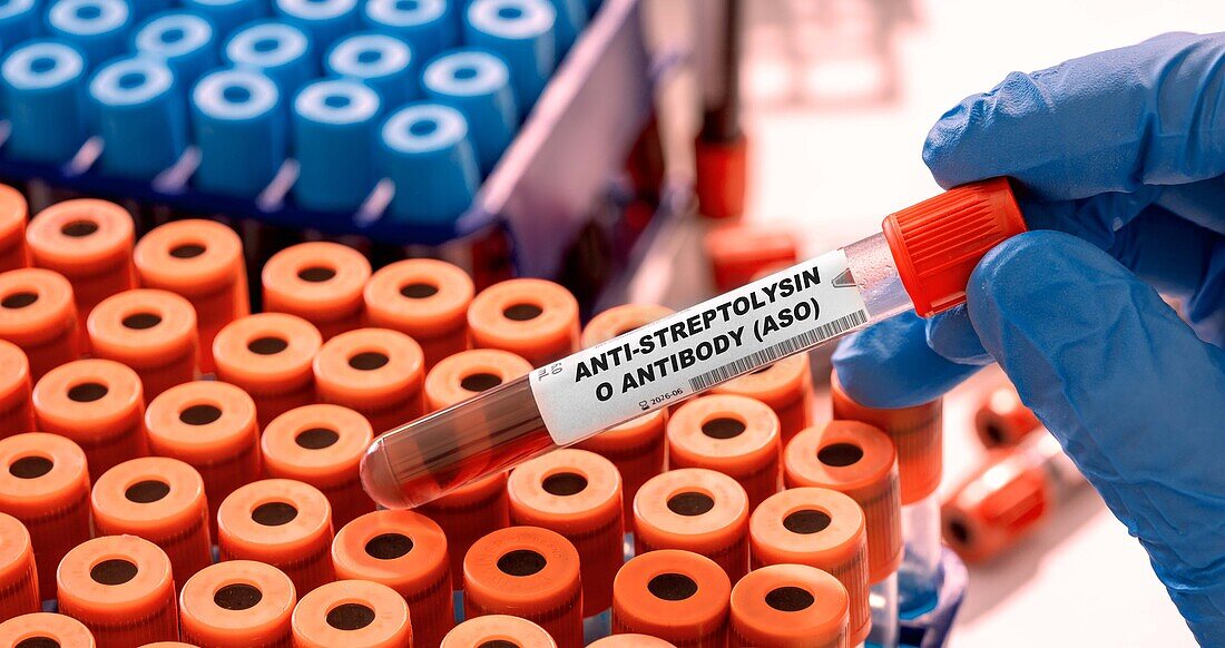 Anti-streptolysin O antibody blood test, conceptual image