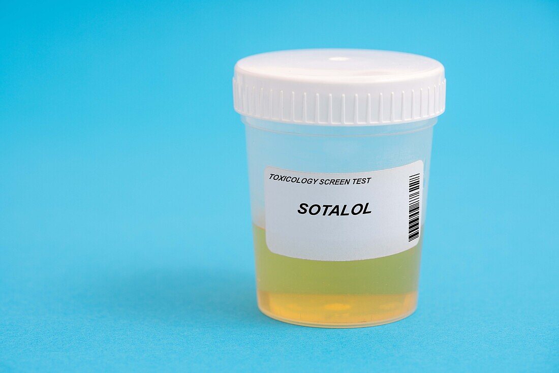 Urine test for sotalol