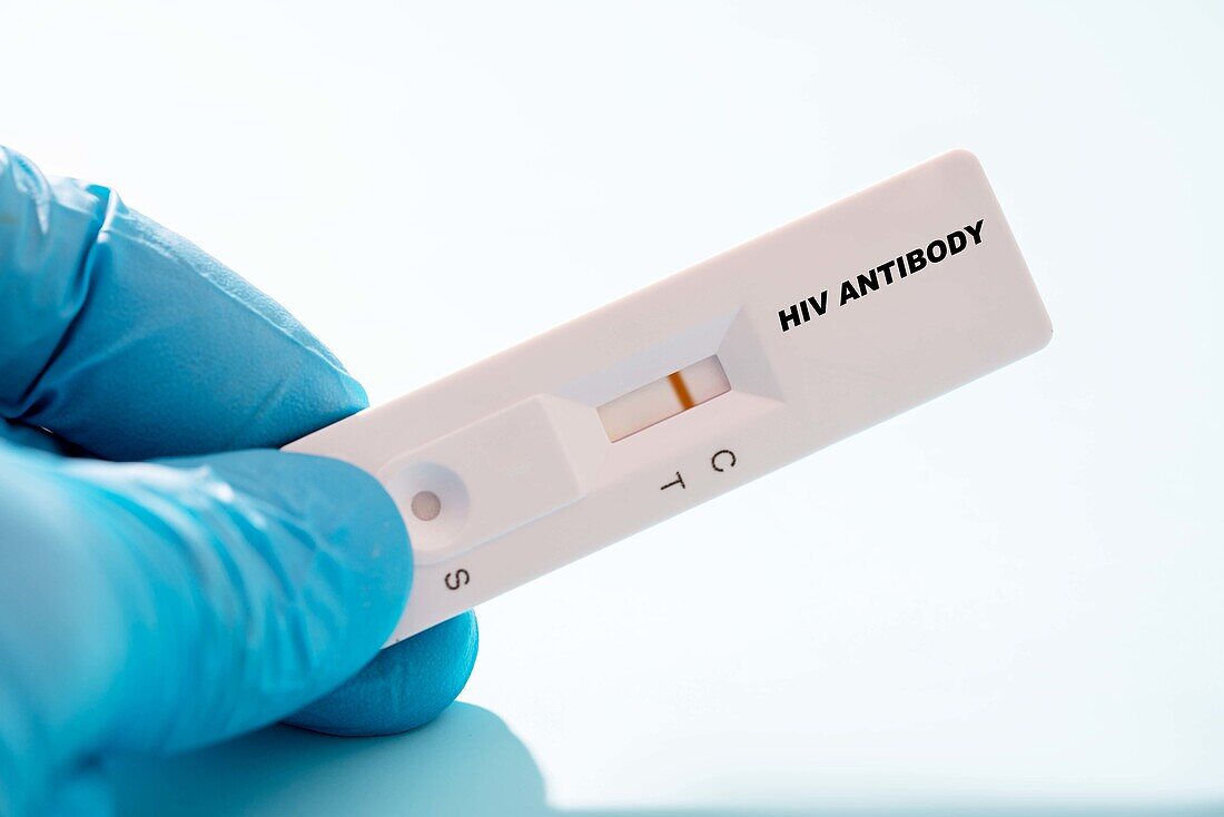 Negative HIV antibody rapid test, conceptual image