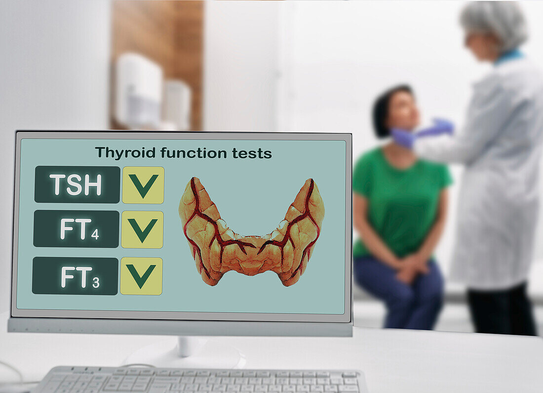 Thyroid function test, conceptual image
