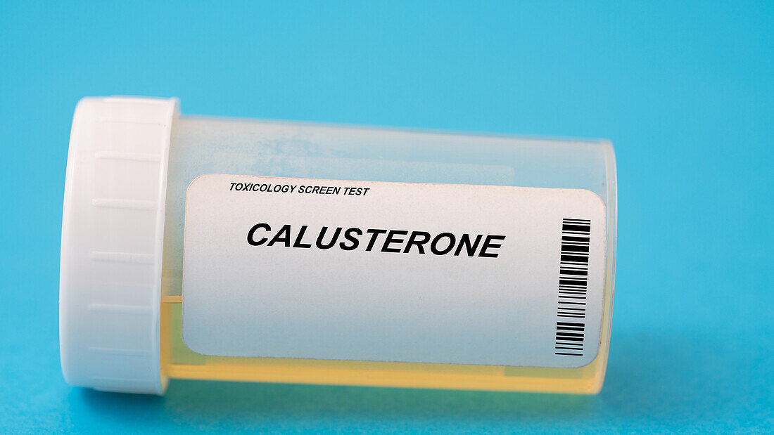 Urine test for calusterone