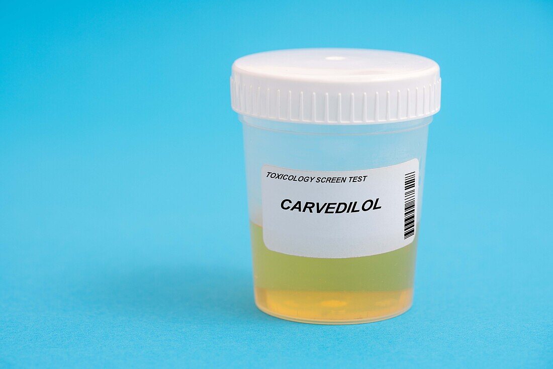 Urine test for carvedilol