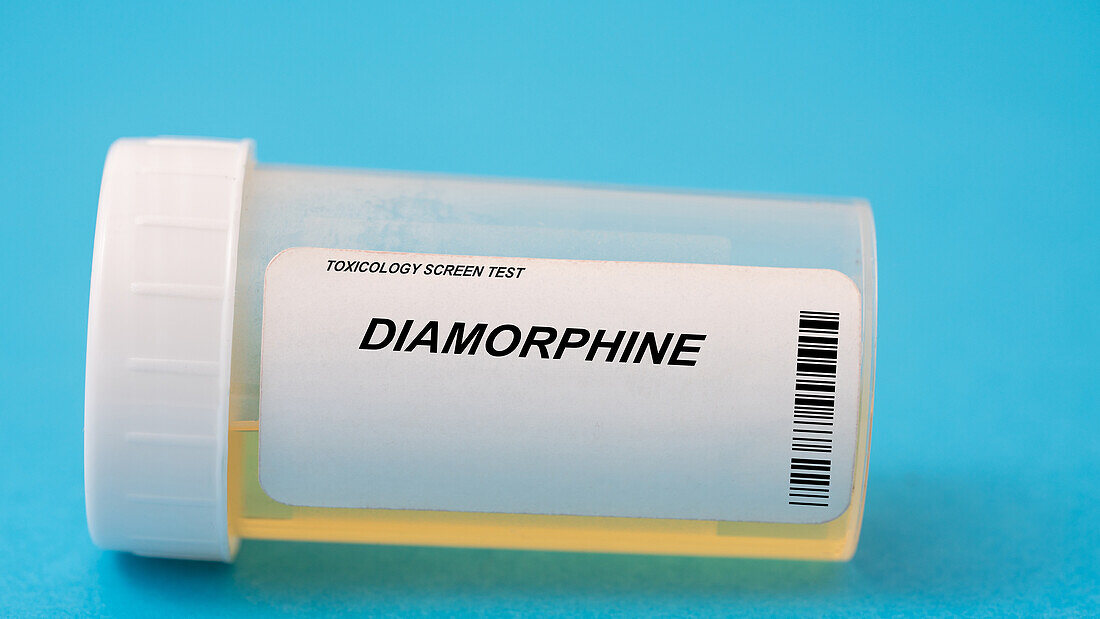 Urine test for diamorphine