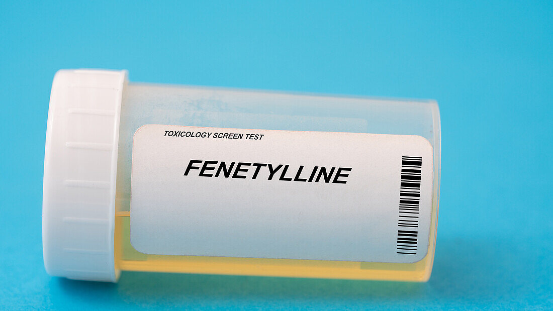Urine test for fenetylline