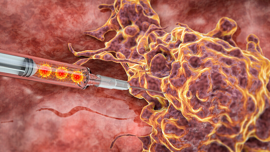 Oncolytic viral therapy, conceptual illustration