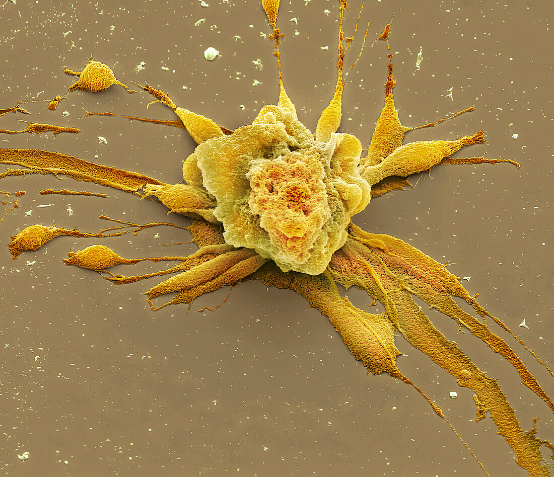 Chemotherapy induced cell death, SEM