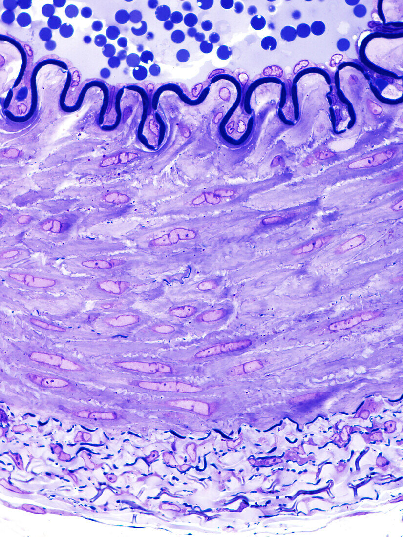 Artery, light micrograph