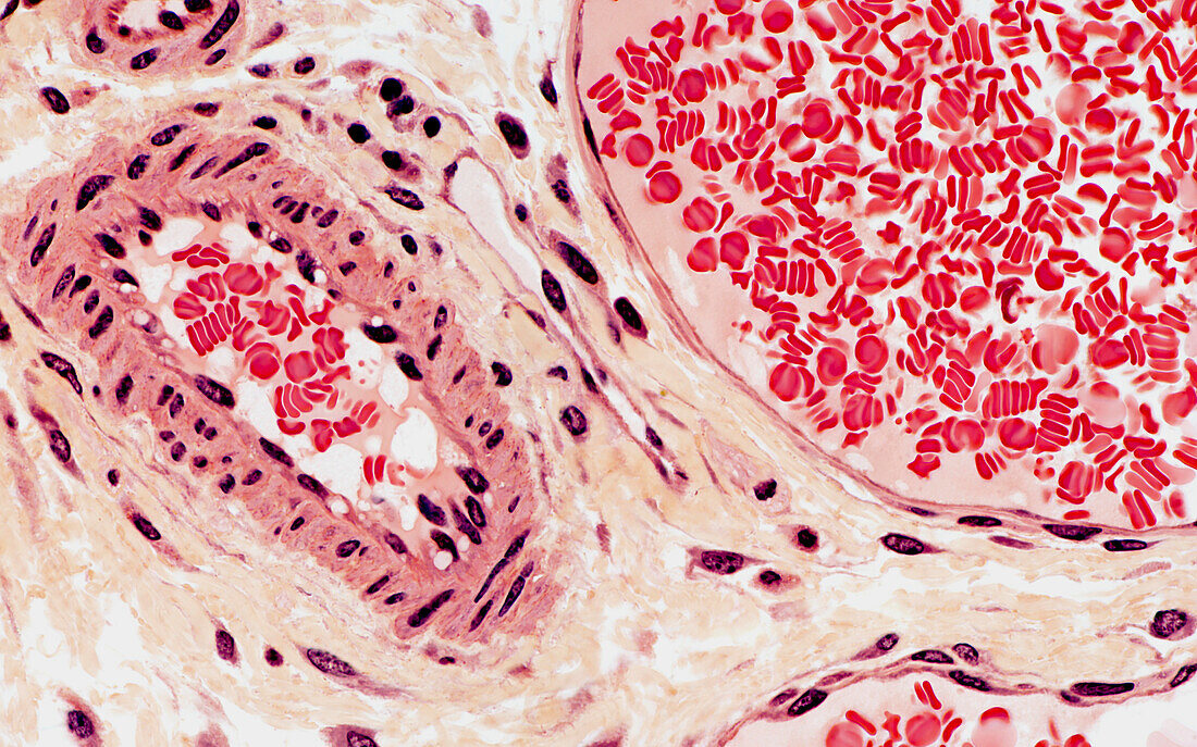 Artery and vein, light micrograph