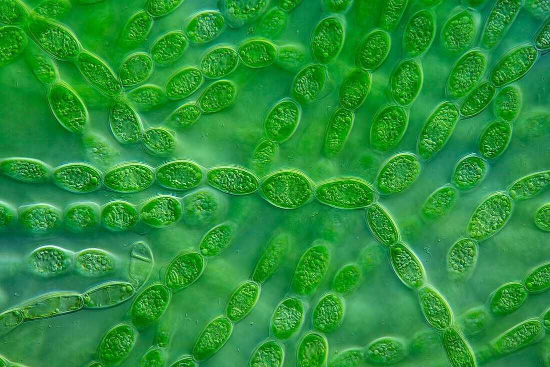 Batrachospermum turfosum algae, light micrograph