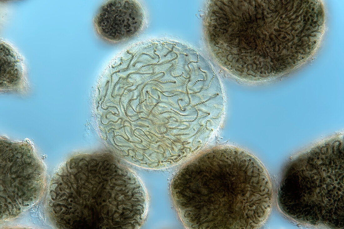 Nostoc pruniforme algae, light micrograph