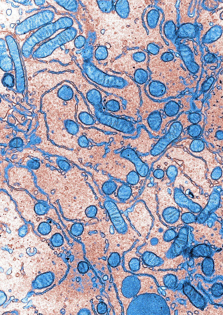Mitochondrial section, TEM