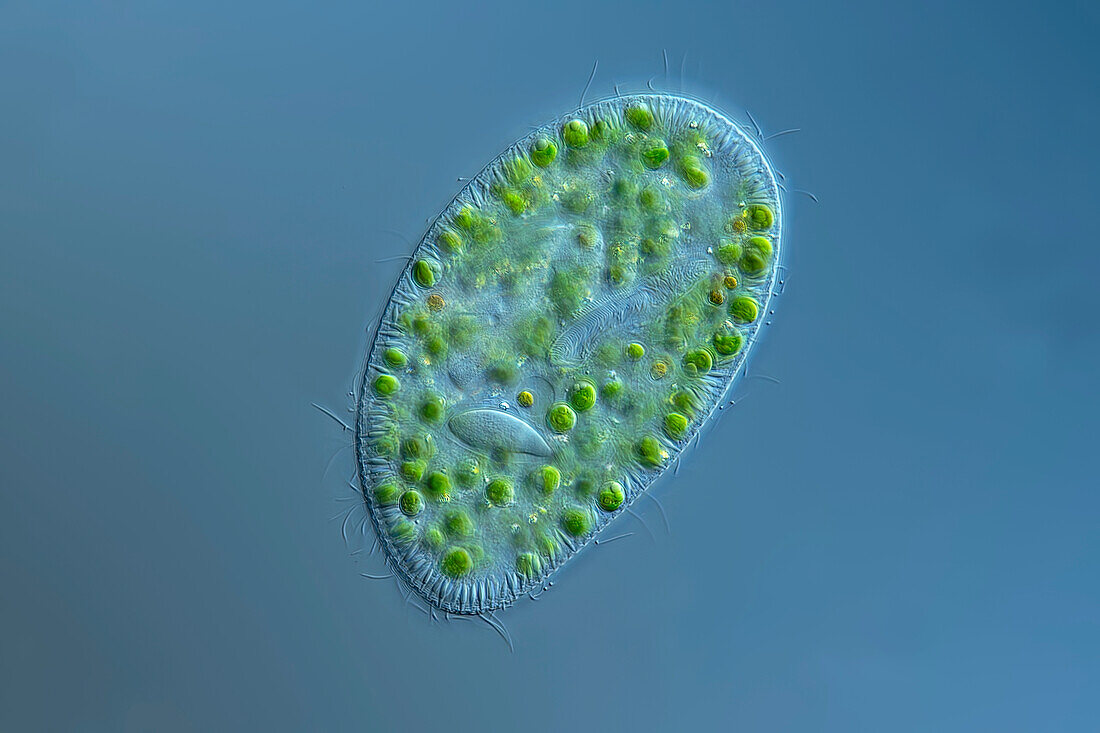 Paramecium bursaria Ciliate, light micrograph
