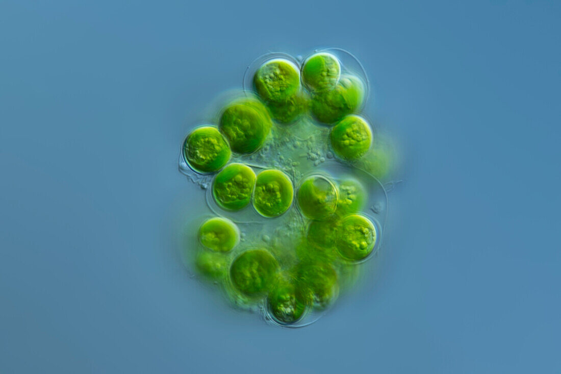 Botryococcus algae, light micrograph