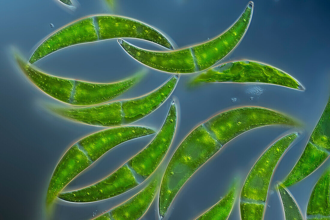 Closterium algae, light micrograph
