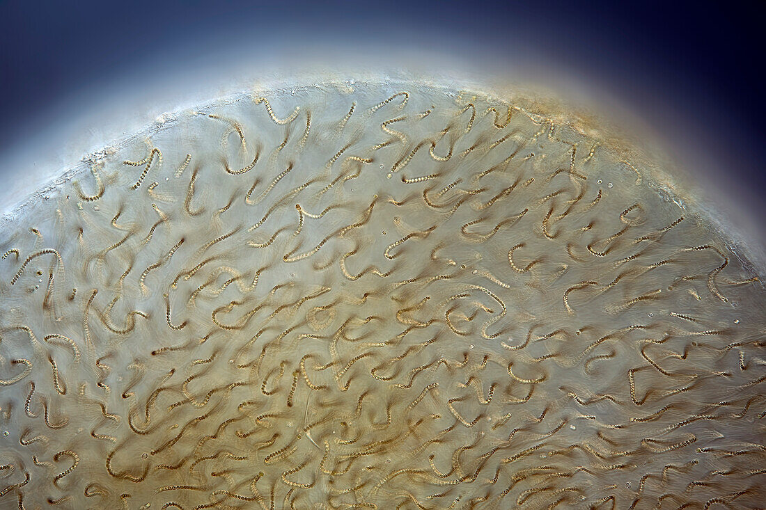 Nostoc pruniforme algae, light micrograph