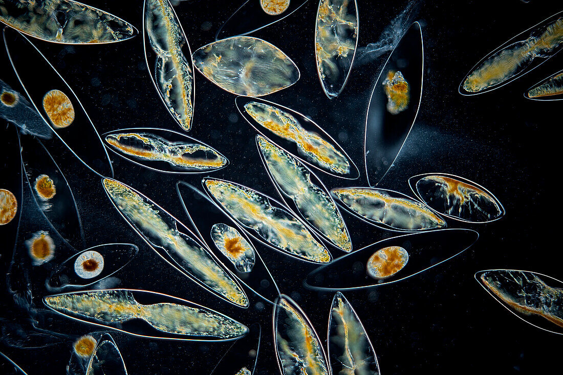 Pyrocystis fusiformis algae, light micrograph