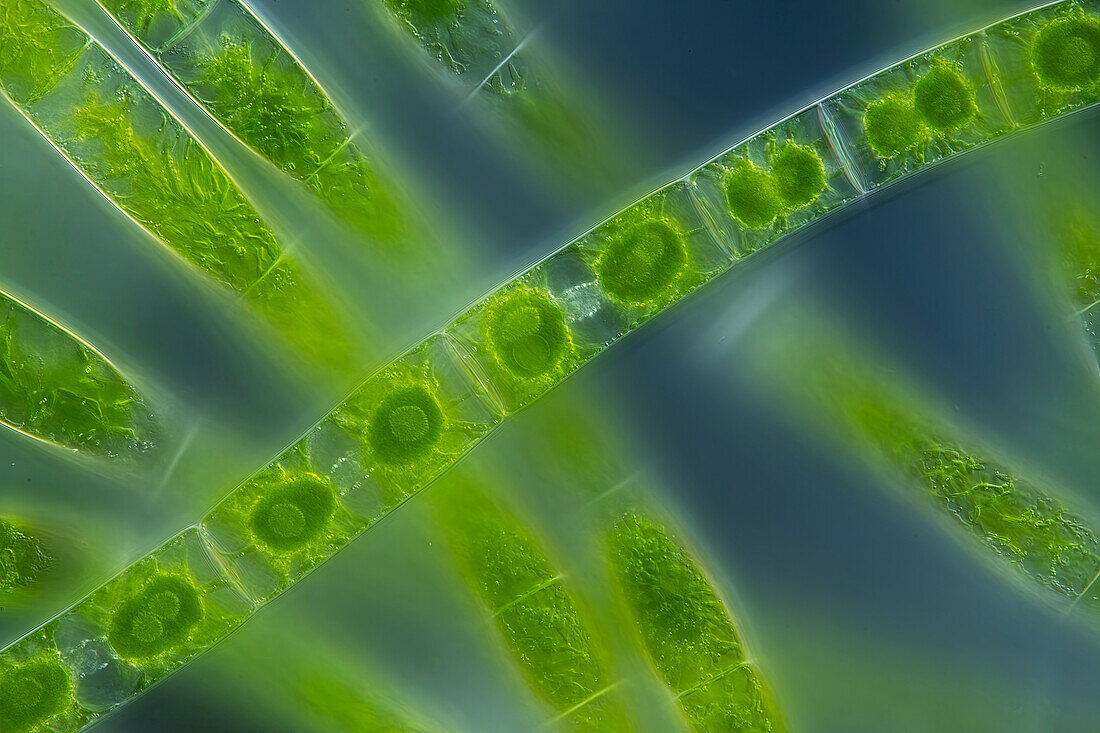 Zygnema algae, light micrograph