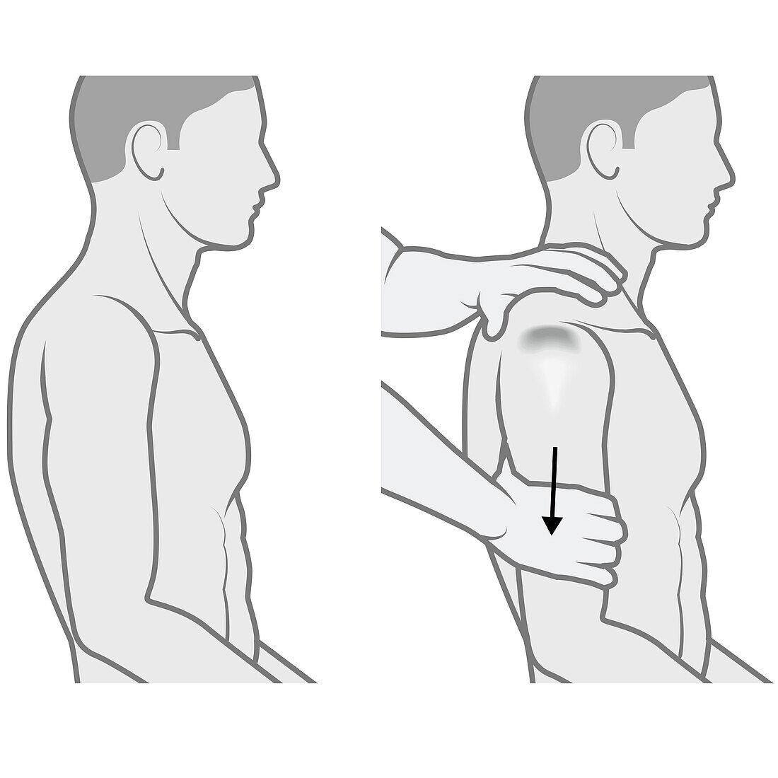 Shoulder examination, illustration