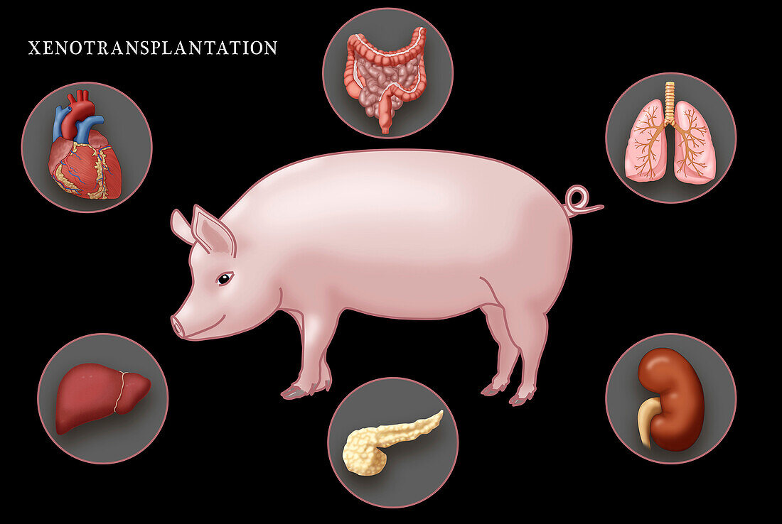Xenotransplantation, illustration