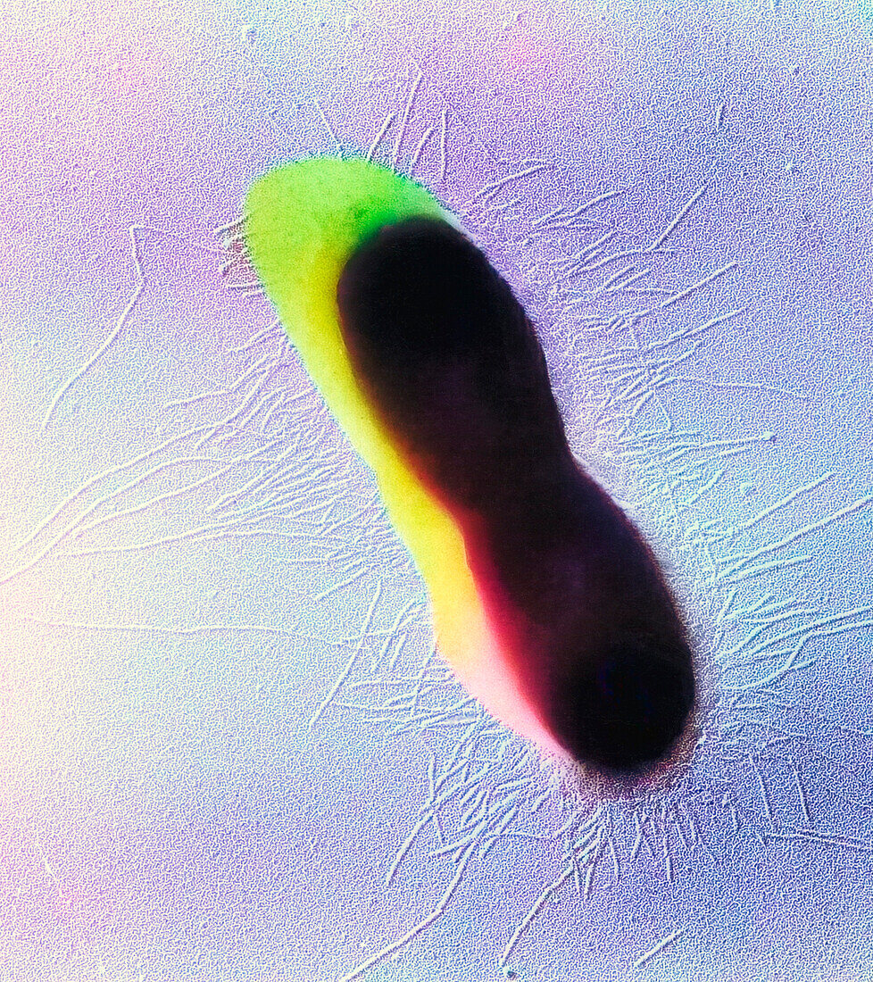 Shadowcast rod bacterium, TEM