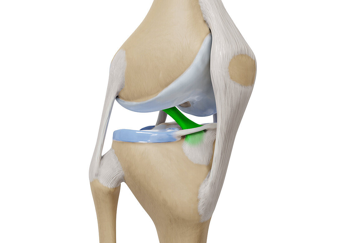Anterior cruciate ligament, illustration