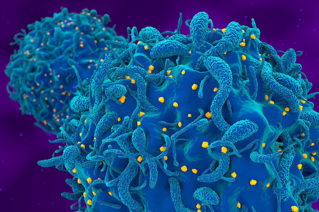 Cells infected with HIV, illustration