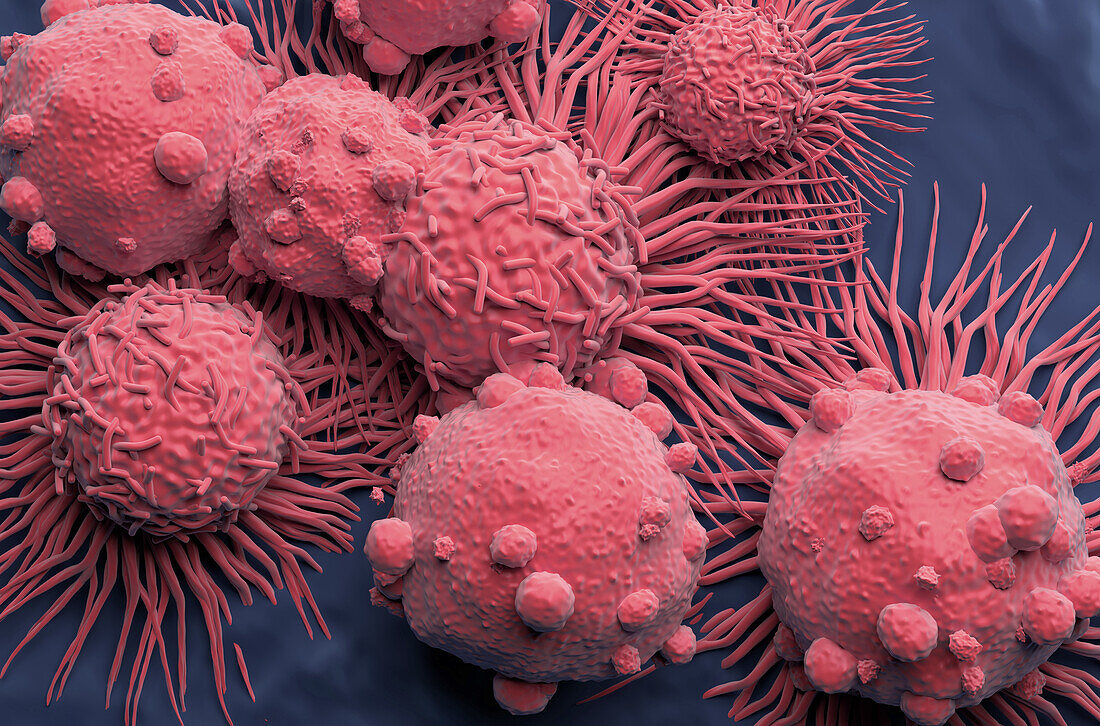 Kidney cancer cells, illustration