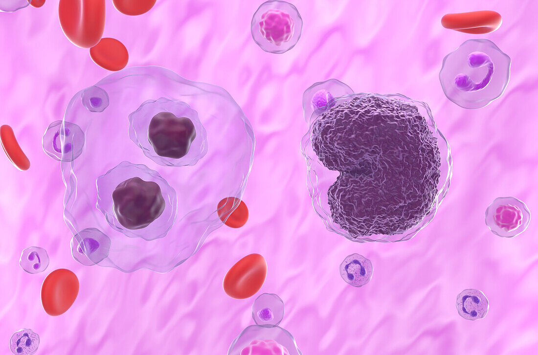 Lymphoma cells, illustration