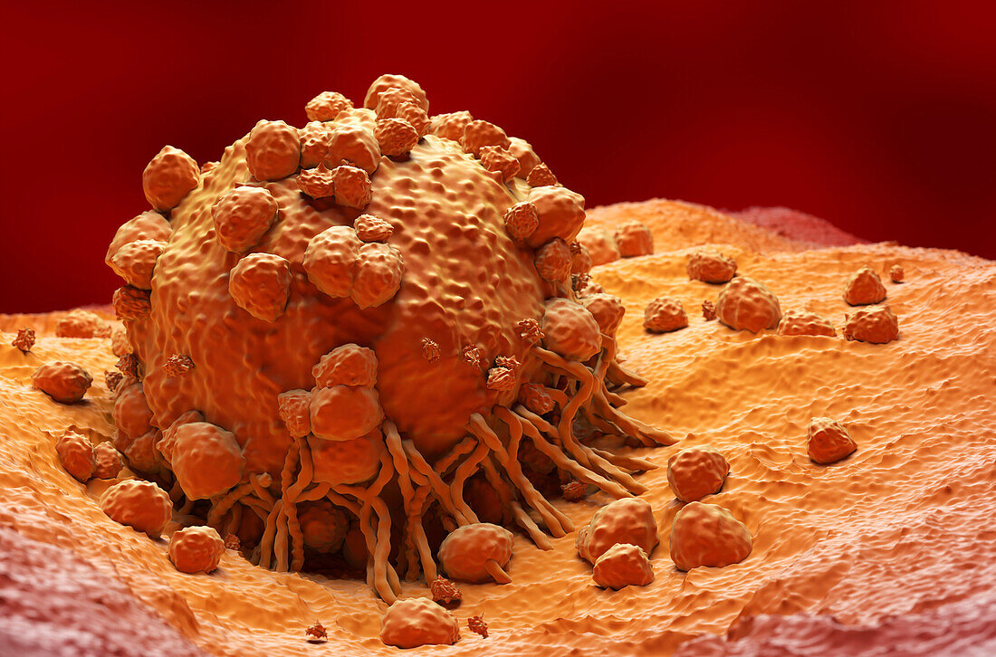 Melanoma cell, illustration