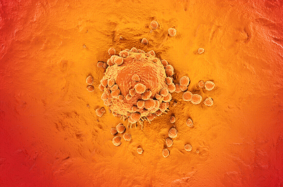 Melanoma cell, illustration
