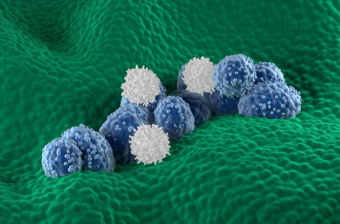 T cells attacking prostate cancer cells, illustration