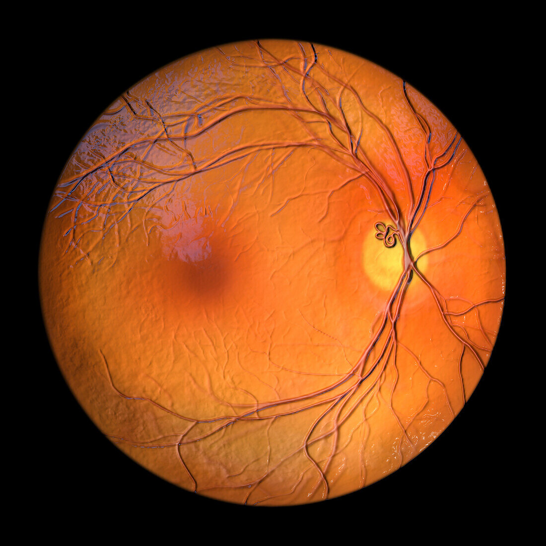 Prepapillary vascular loop on the retina, illustration