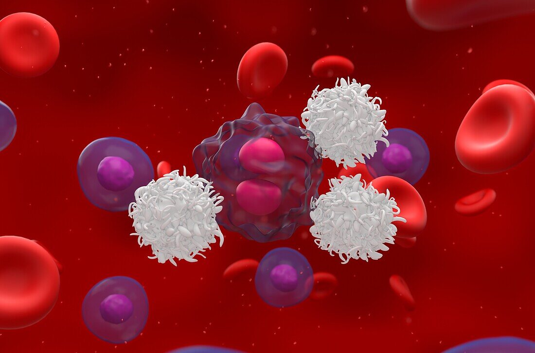 T cells attacking lymphoma cell, illustration