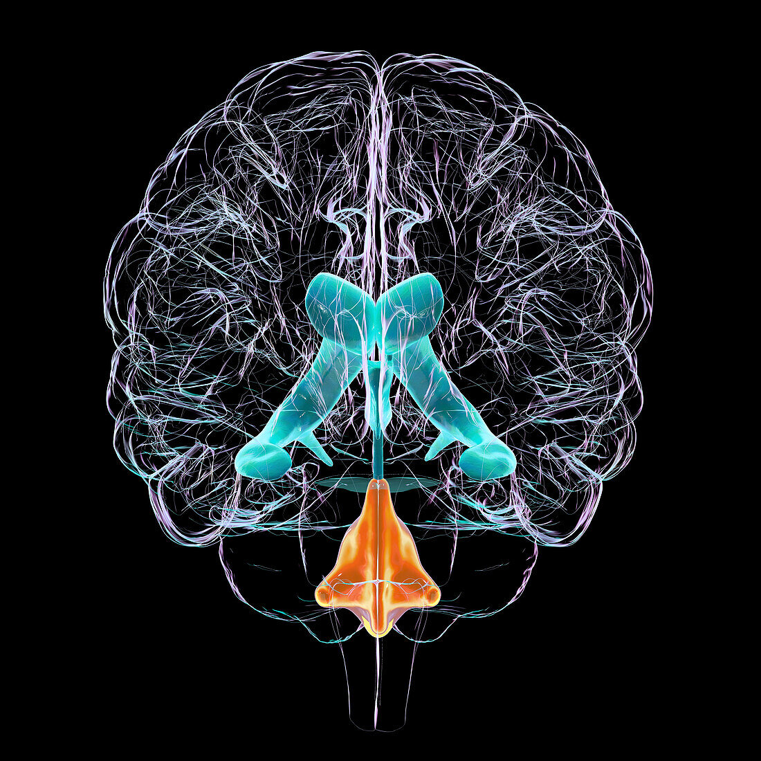 Enlarged fourth ventricle of the brain, illustration
