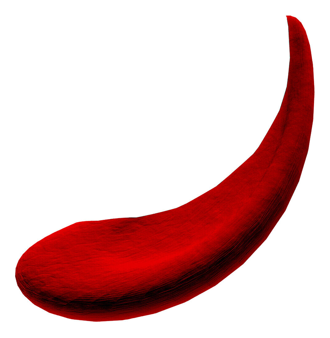 Sickle cell disease blood cell, illustration