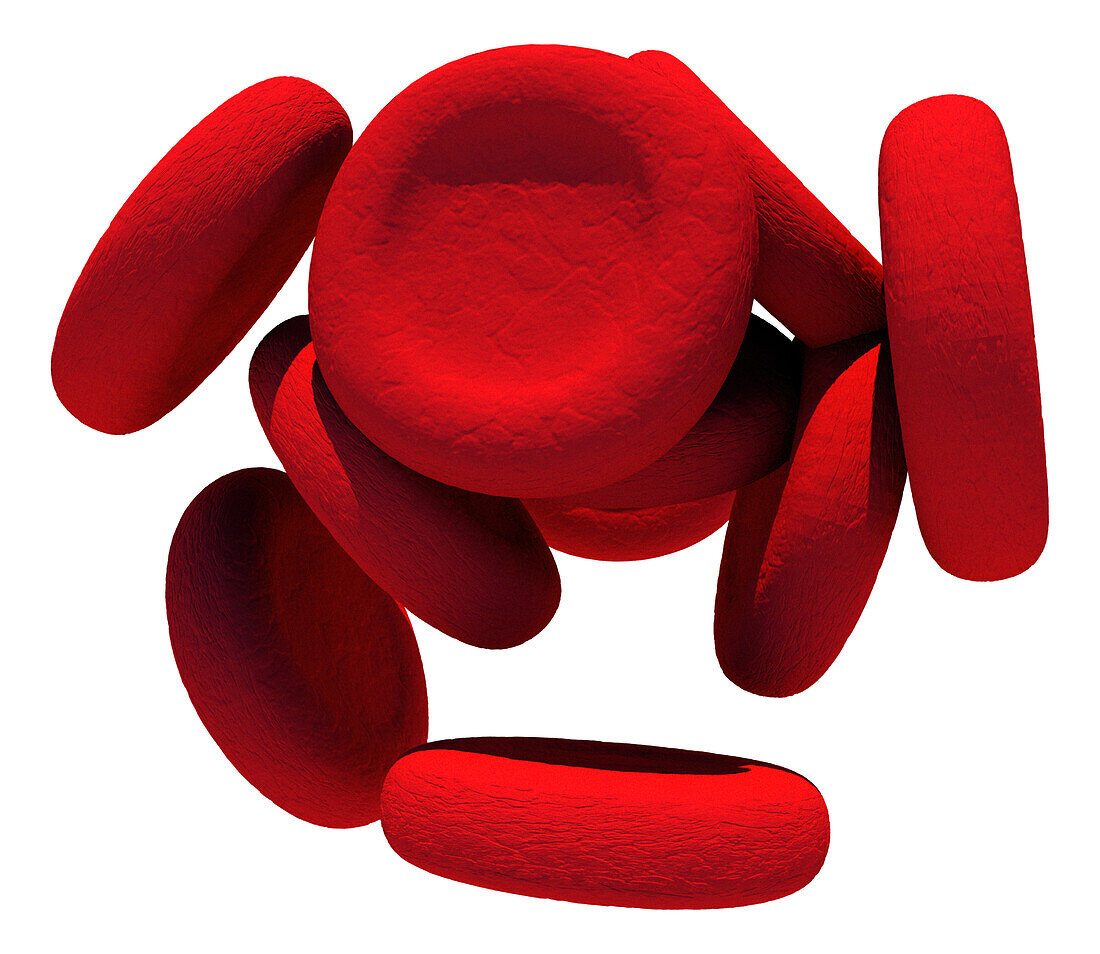 Agglutinated red blood cell, illustration